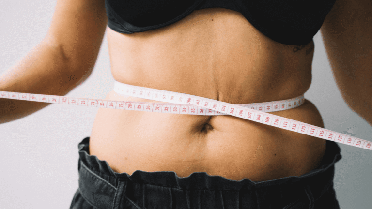 Abdominal measurement for tummy tuck surgery