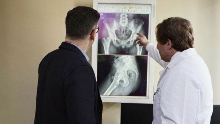 Orthopedic surgeon in Spain reviewing a hip replacement X-ray with a patient