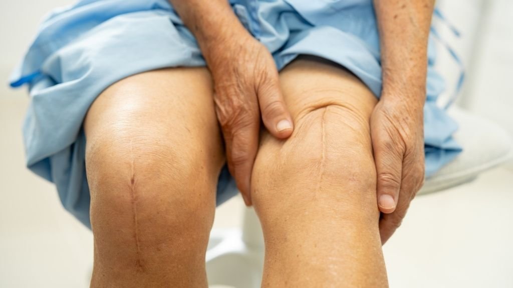 Patient after knee replacement surgery in Spain